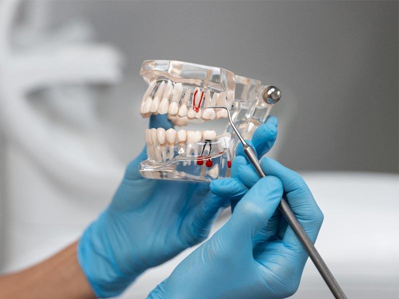 Nadogradnja-zuba-Cetkovic-dental-studio